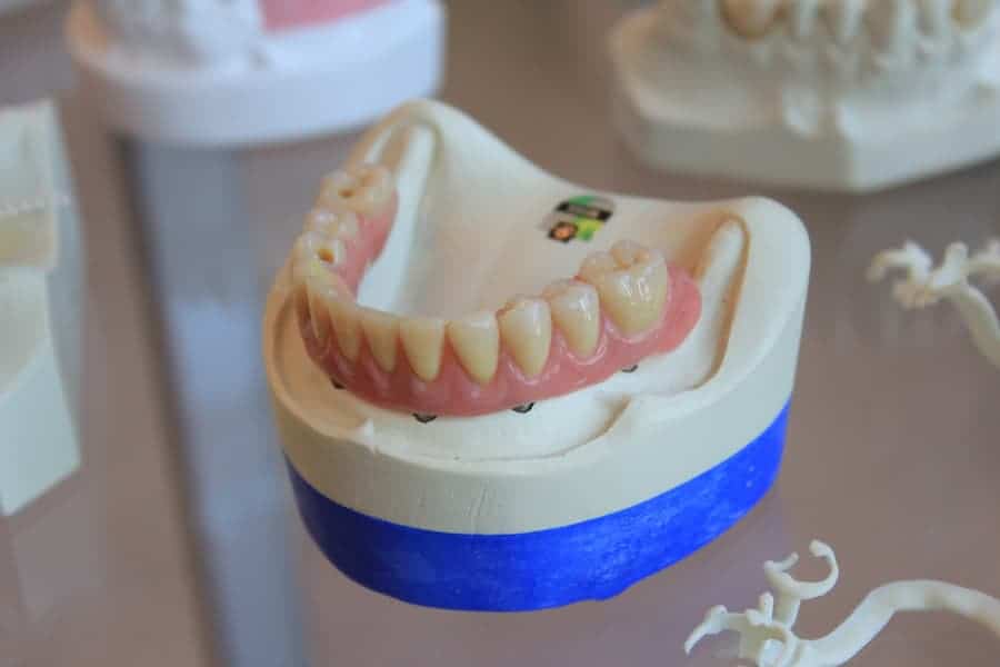 Gold teeth dentures displayed on the table