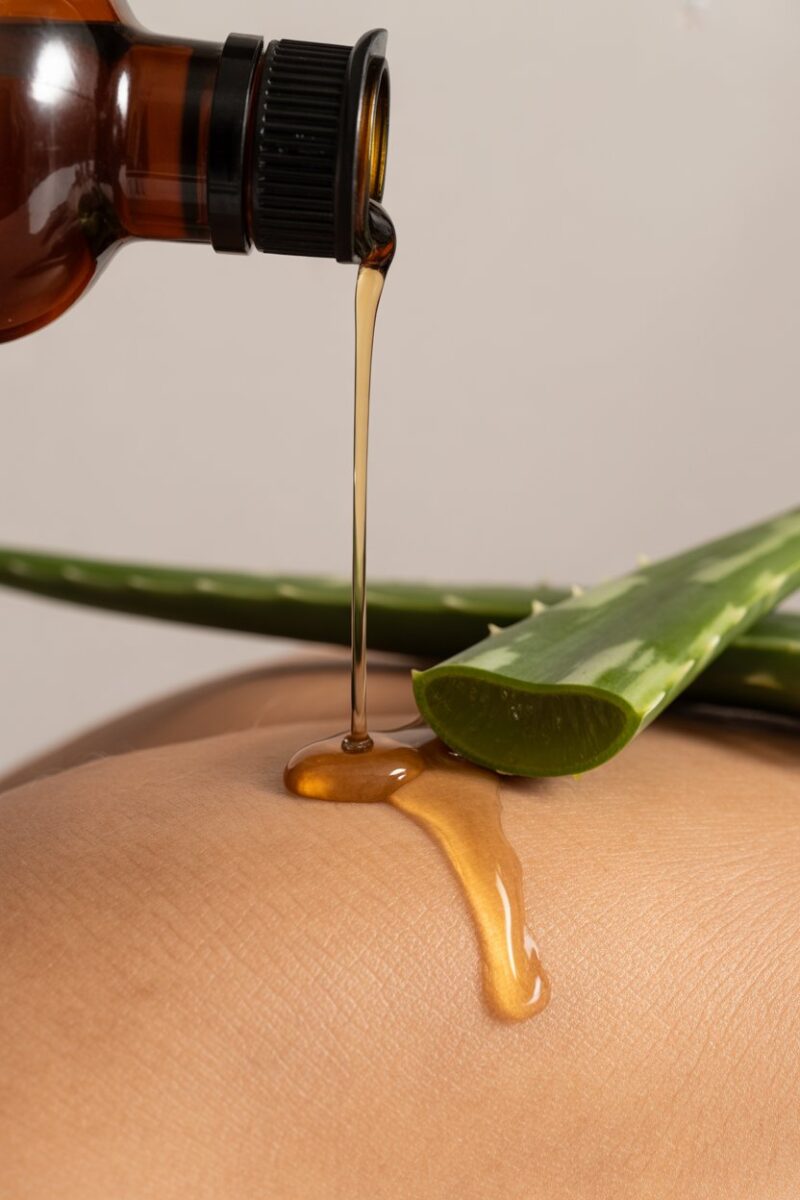 A bottle of vinegar pouring onto skin with aloe vera beside it.